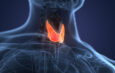 Could You Have a Thyroid Problem and Not Know It?