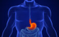 Acid Reflux Common But Treatable