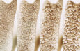 Medication Can Raise Osteoporosis Risk
