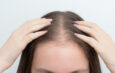 Why Women Lose Hair as They Age